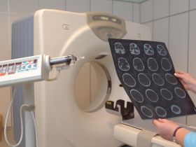 Niebawem testy urządzeń radiologicznych według zmienionych przepisów