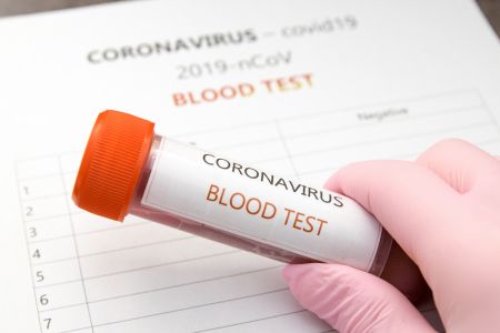 Szybkie testy na COVID-19 dla pracowników jako środek profilaktyczny